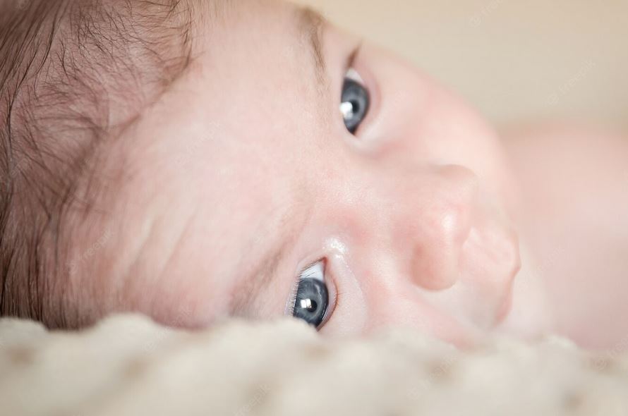 bayi prematur terancam penyakit Retinopati Prematuritas
