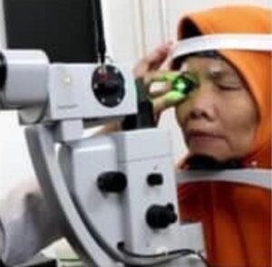 operasi Katarak Phaco