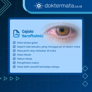 gejala Xeroftalmia