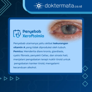 Penyebab Xeroftalmia