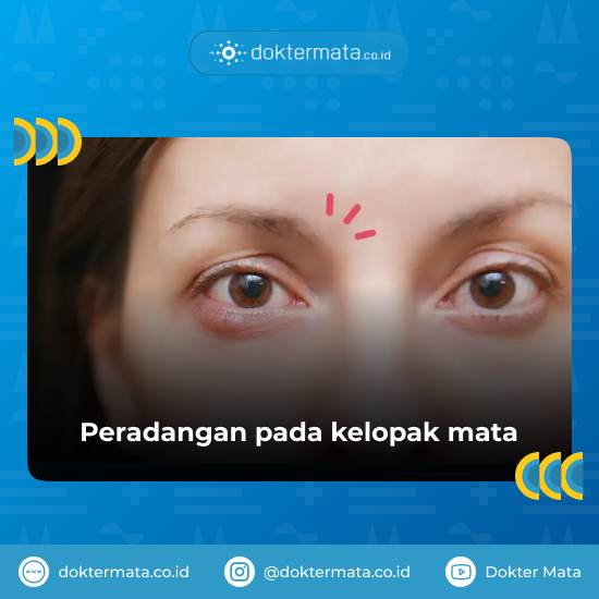 Kurang Bersih Hapus Make Up Mata