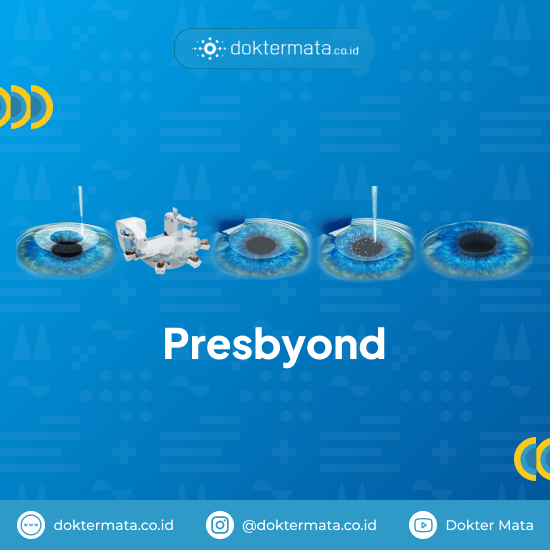 Presbyond - Solusi Bebas Kacamata di Segala Usia