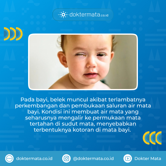 Penyebab Mata Bayi Belekan