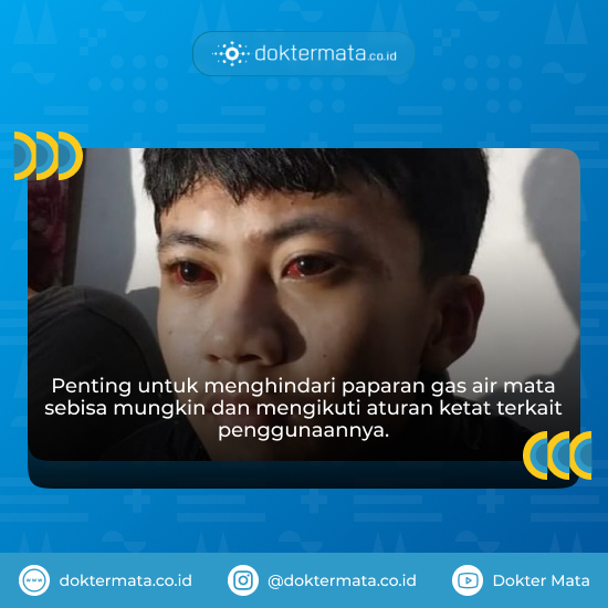Efek Gas Air Mata Pada Mata