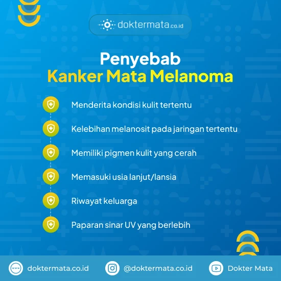 Penyebab Kanker Mata Melanoma