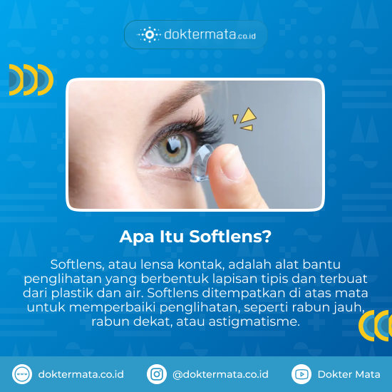 Apa itu softlens - Lensa Ortho-K