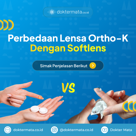 Perbedaan Lensa Ortho-K dengan Softlens