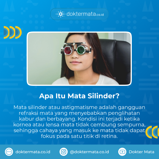 Mengenal apa itu mata silinder - mata silinder turunan