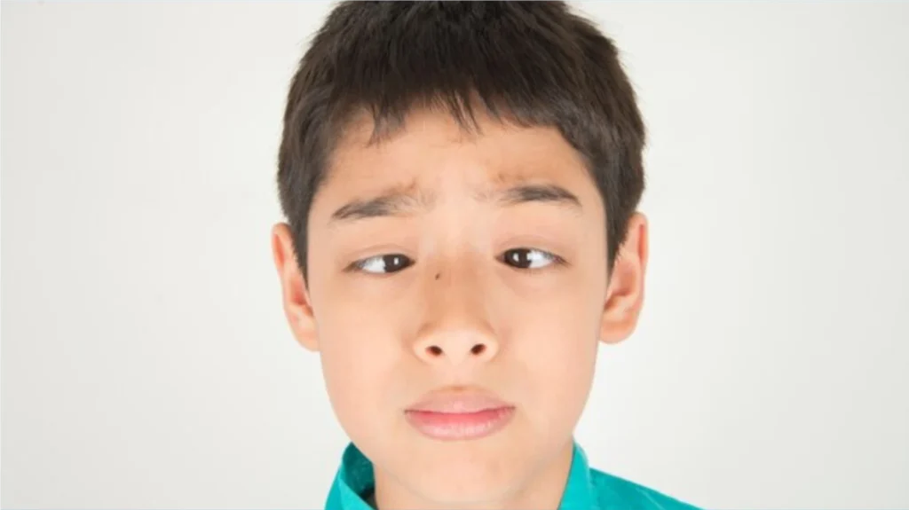 Strabismus (mata juling)