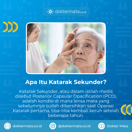Katarak Sekunder - Biaya Laser Nd Yag