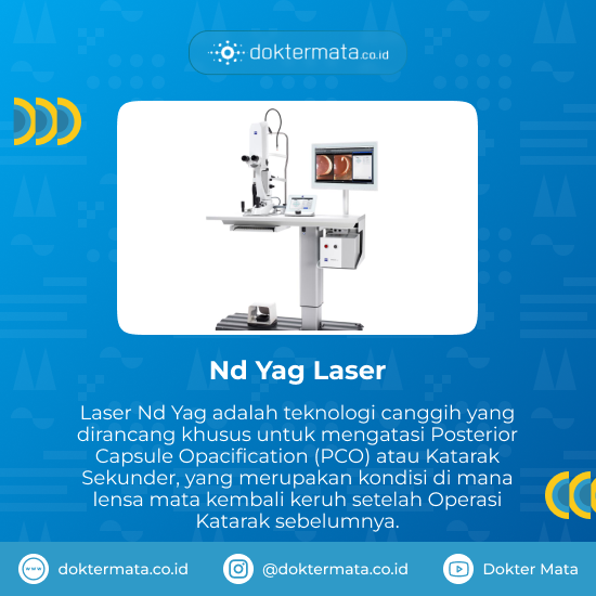 Nd Yag Laser Untuk Katarak Sekunder - Biaya Laser Nd Yag