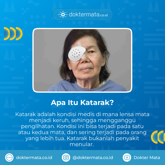 Apa Itu Katarak - Operasi Katarak di Surabaya