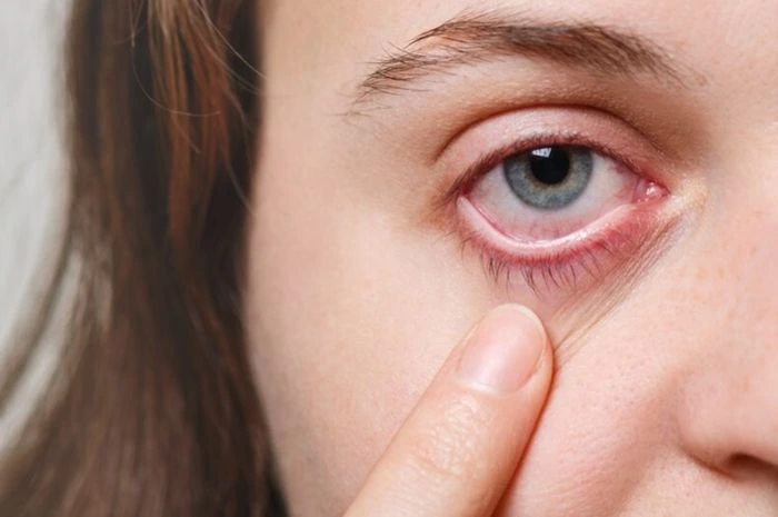 Kondisi Penglihatan Penderita Diabetes