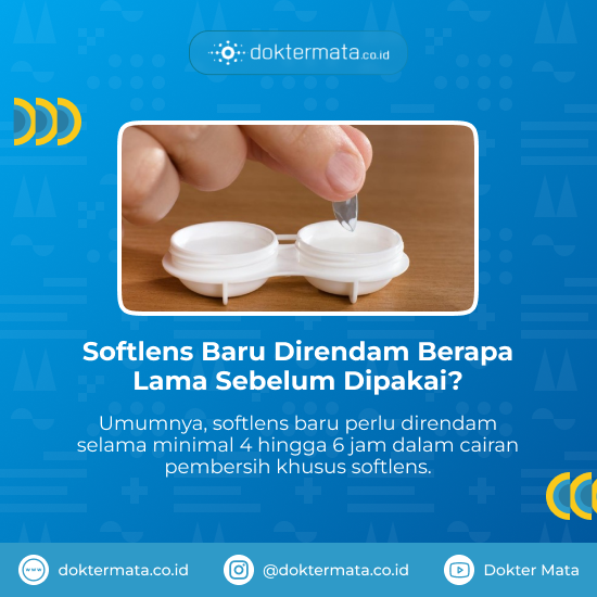 Softlens Baru Direndam Berapa Lama Sebelum Dipakai