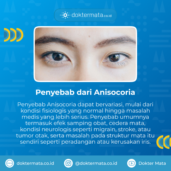 Penyebab dari Anisocoria