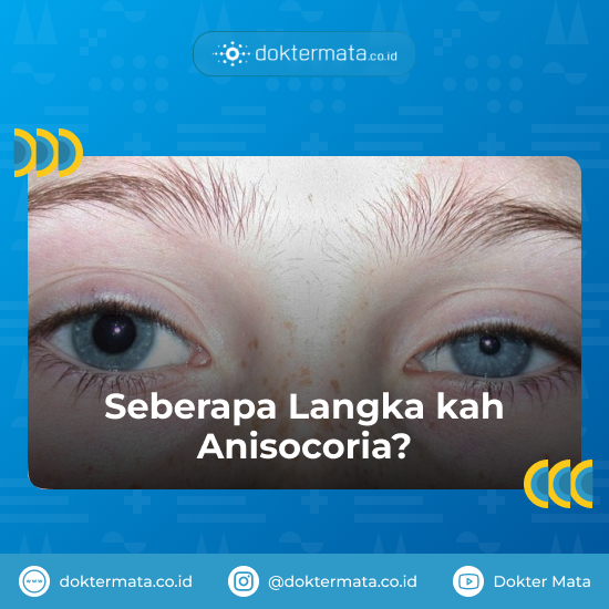 Seberapa Langka kah Anisocoria
