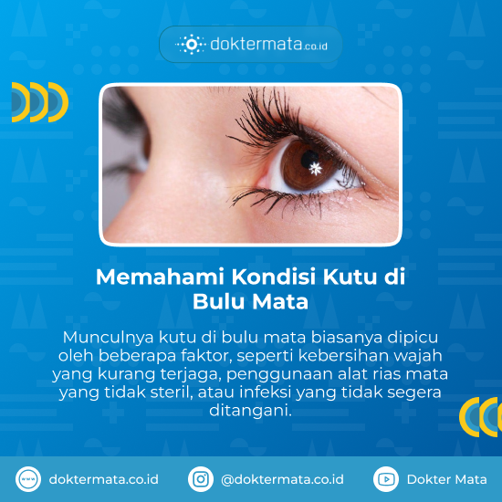 Memahami Kondisi Kutu di Bulu Mata