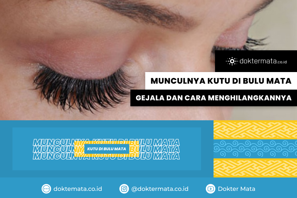 Munculnya Kutu di Bulu Mata, Gejala dan Cara Menghilangkannya