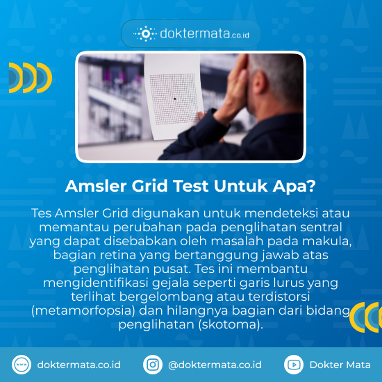 Amsler Grid Test Untuk Apa_
