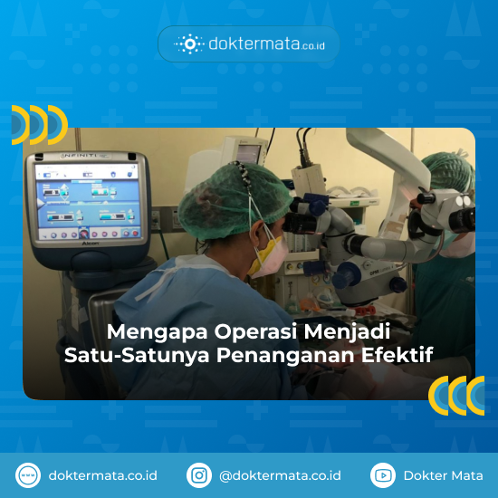 Mengapa Operasi Menjadi Satu-Satunya Penanganan Efektif - Faktor Risiko Katarak