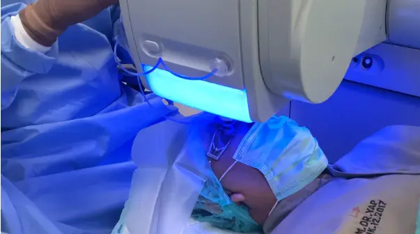 Lasik berbahaya atau tidak