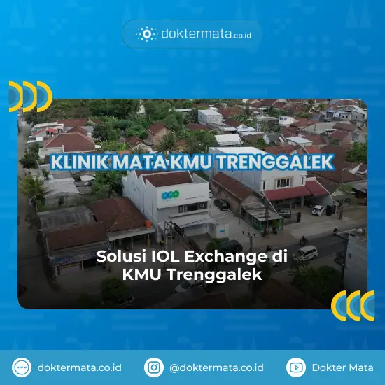 Solusi IOL Exchange di KMU Trenggalek