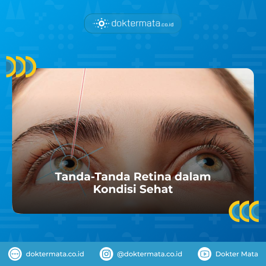 Tanda-Tanda Retina dalam Kondisi Sehat - Retina Sehat