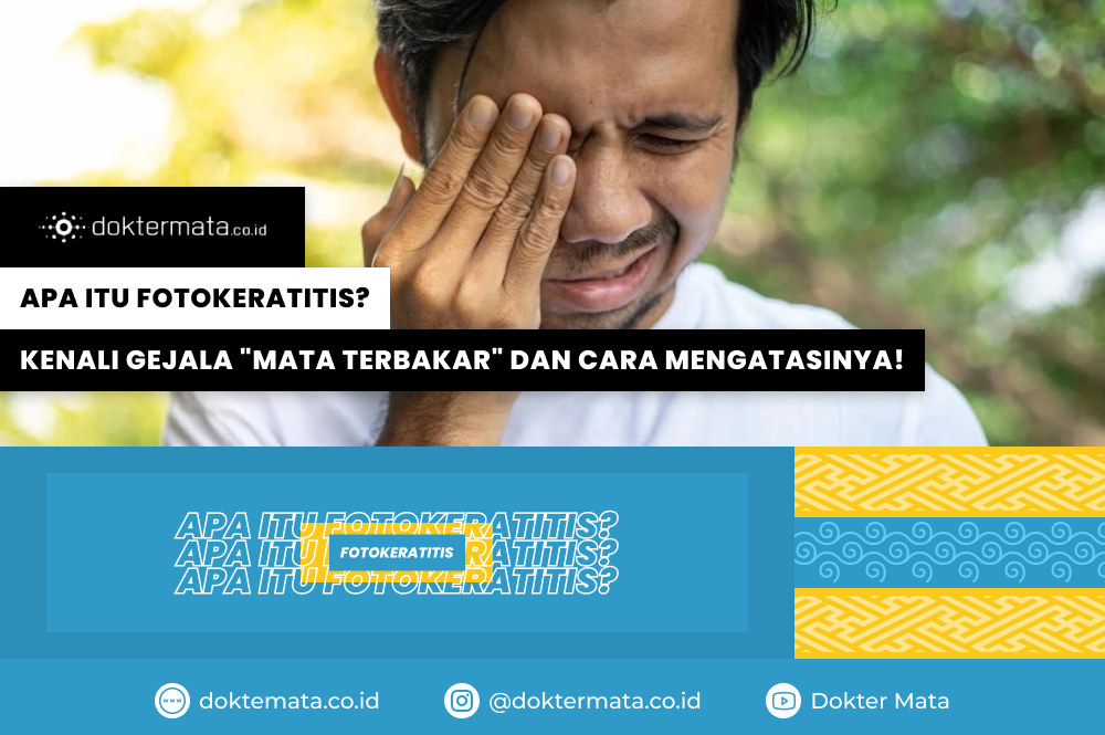 Apa Itu Fotokeratitis_ Kenali Gejala _Mata Terbakar_ dan Cara Mengatasinya!