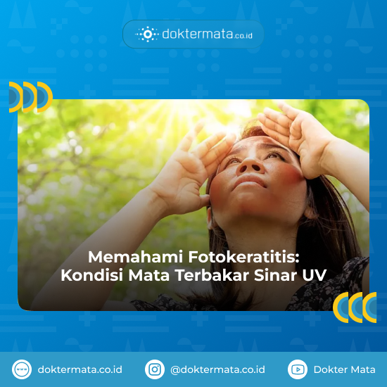 Memahami Fotokeratitis_ Kondisi Mata Terbakar Sinar UV