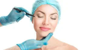 Blepharoplasty