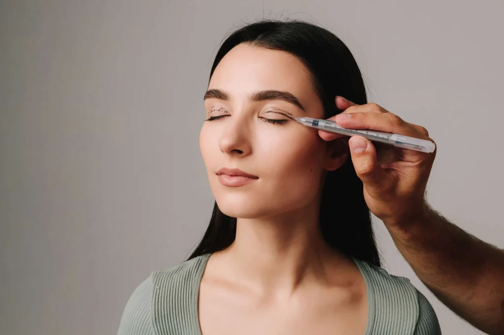 Blepharoplasty