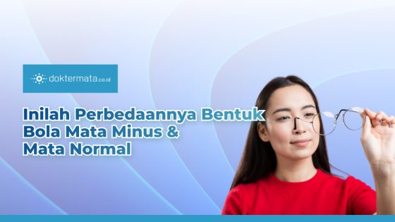 Inilah Perbedaannya Bentuk Bola Mata Minus & Mata Normal