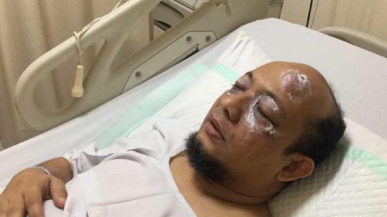Berita Mata - Seperti Apa Operasi Cangkok Mata yang Akan Dilakukan Oleh Novel Baswedan di Singapura