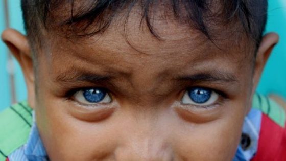 Berita mata - Kisah Bocah Buton yang Memiliki Bola Mata Biru 1