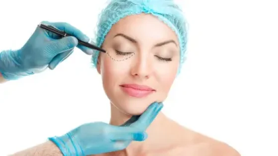 Blepharoplasty
