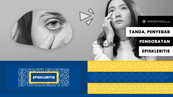 Episkleritis: Tanda, Penyebab & Pengobatan