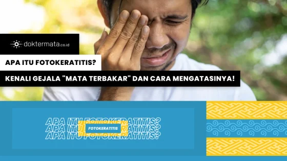 Apa Itu Fotokeratitis_ Kenali Gejala _Mata Terbakar_ dan Cara Mengatasinya!