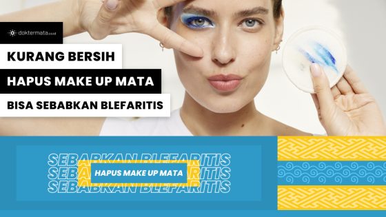 Kurang Bersih Hapus Make Up Mata Bisa Sebabkan Blefaritis
