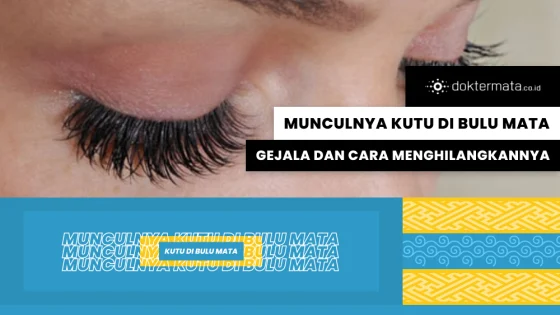 Munculnya Kutu di Bulu Mata, Gejala dan Cara Menghilangkannya