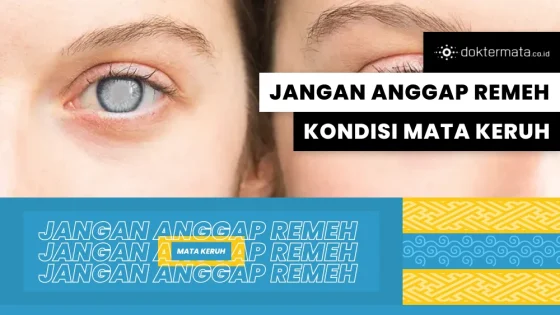 Jangan Anggap Remeh Kondisi Mata Keruh!