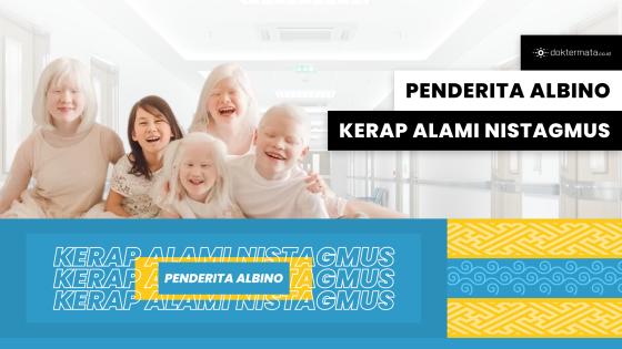 Penderita Albino Kerap Alami Nistagmus