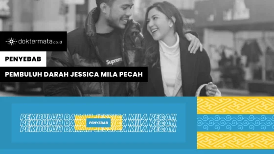 Inilah Penyebab Dari Pembuluh Darah Jessica Mila Pecah
