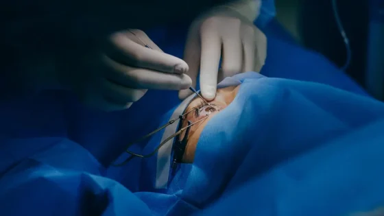 Syarat Operasi Katarak