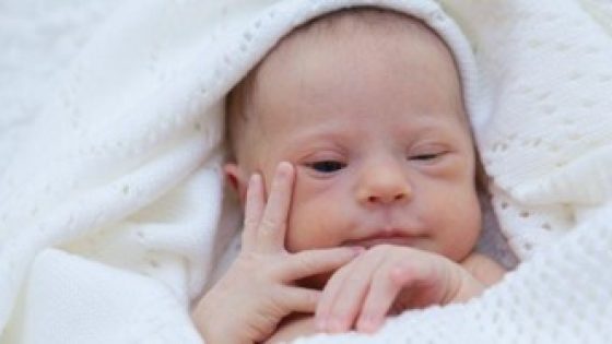 Ptosis bayi