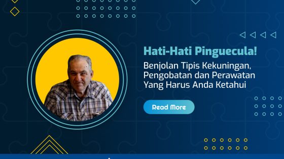 Pinguekula