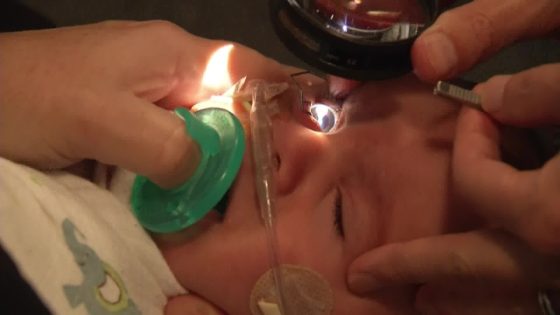 Mata bayi prematur