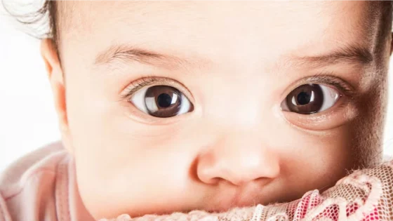 Strabismus (mata juling): Ciri-ciri Beserta Pengobatannya