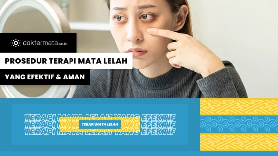 Prosedur Terapi Mata Lelah Yang Efektif & Aman