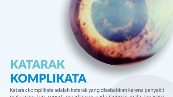 katarak komplikata