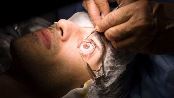 operasi lasik